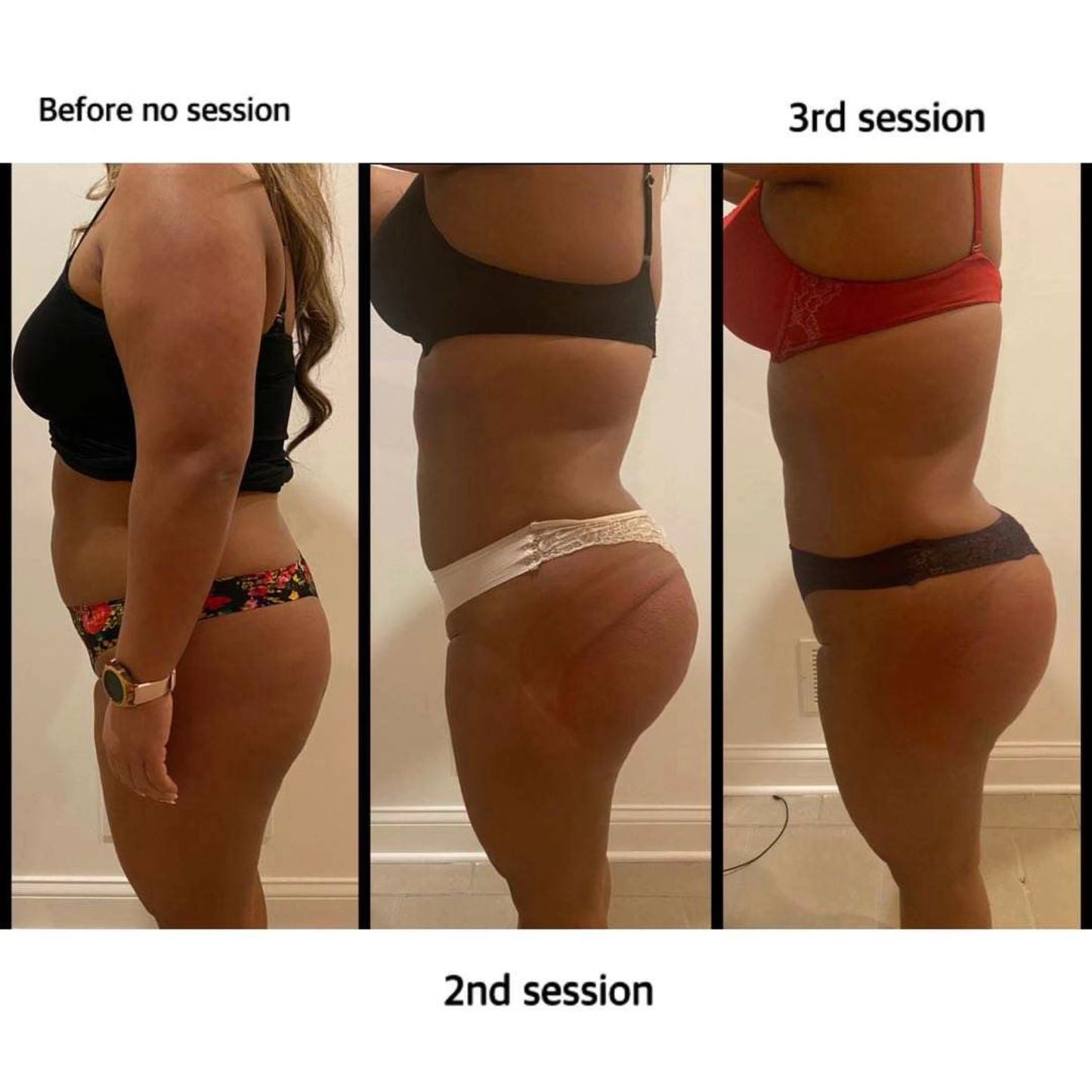 Hot sale 8-in-1 80k cavitation machine