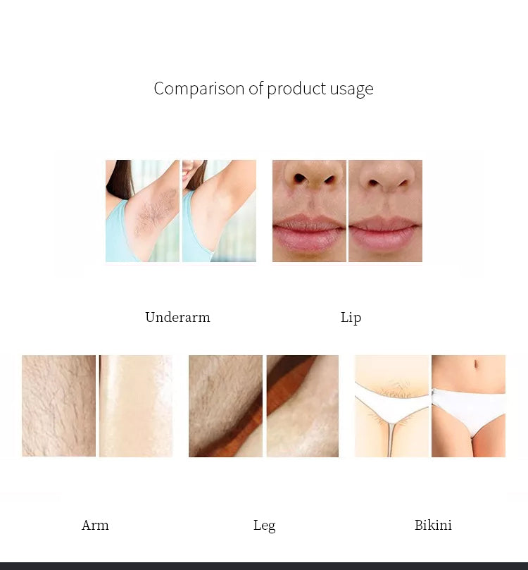 diode laser portable factory price 808 painlss hair removal lazer price home use diode laser hair removal machine