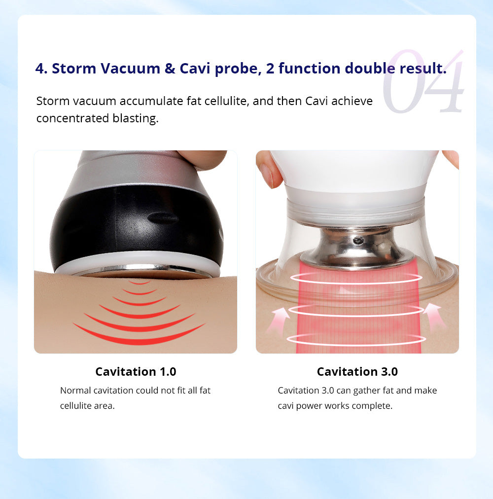 3.0 CaVstorm Body S-shaping Skin Firming Professional Beauty Machine